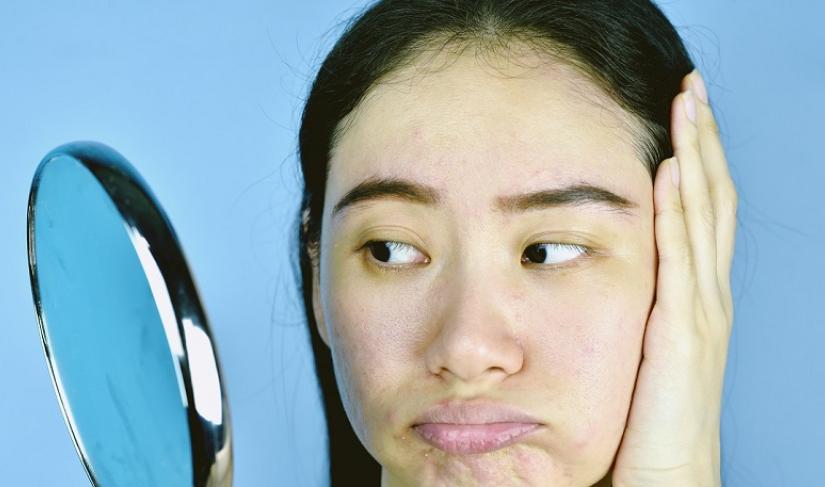 Tiga Bahan Alami Cegah Kulit Kering  Akibat Sering Cuci Tangan